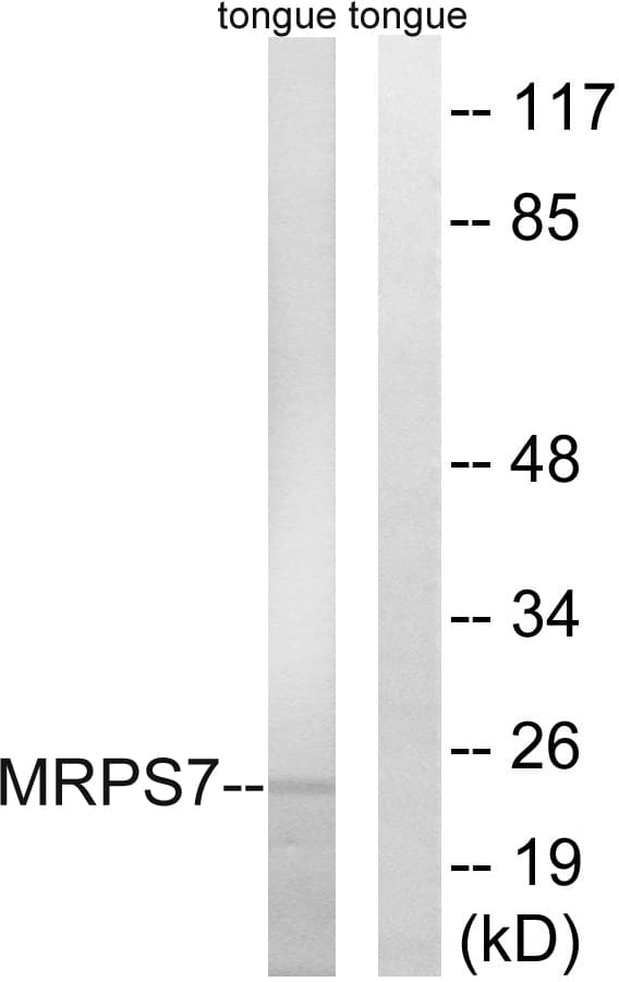 Polyclonal Rabbit anti-Human MRPS7 Antibody (aa91-140, IHC, WB)