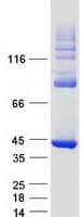 Human HAO1 Protein (Recombinant Myc-DDK (Flag))