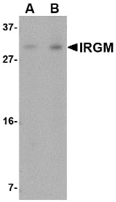 Polyclonal Rabbit anti-Human IRGM / LRG-47 Antibody (IHC, IF, WB)