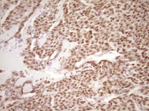 LPIN1 / Lipin 1 Antibody (clone OTI8F10)