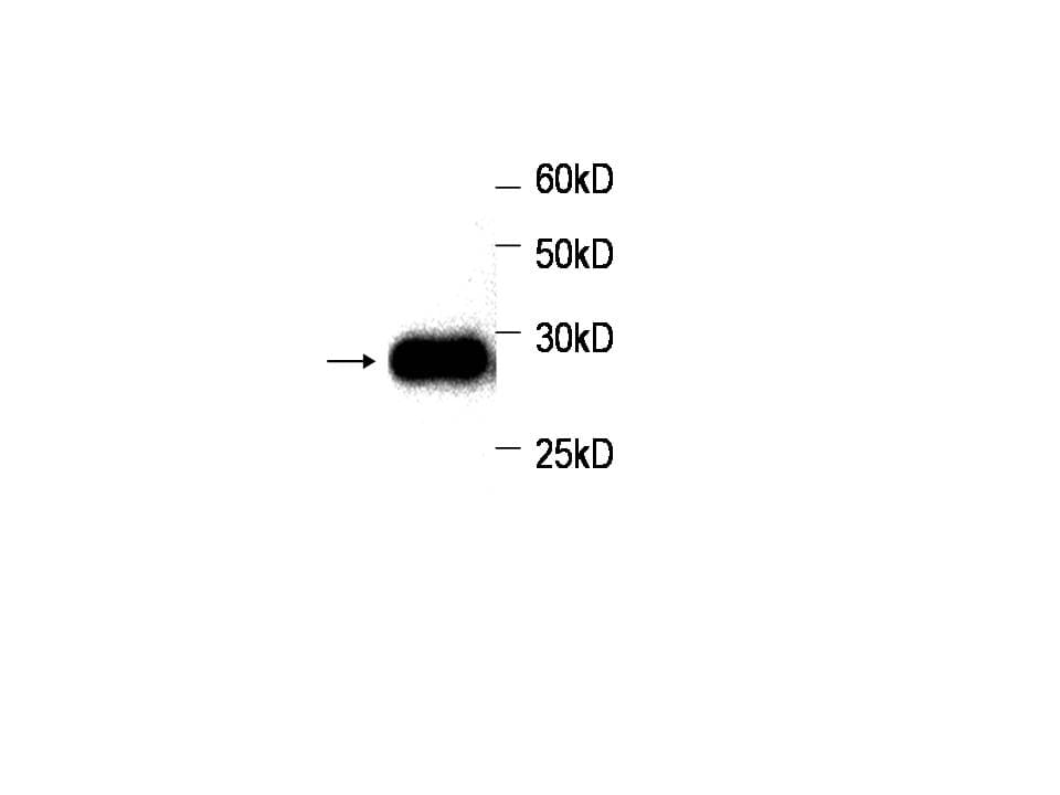 PathPlus™ Monoclonal Mouse anti-Human CREM / ICER Antibody (IHC, WB)