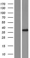 FKBP6 Protein (Over-Expression Lysate Myc-DDK (Flag))