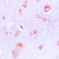 ECI2 / PECI Antibody (Internal)