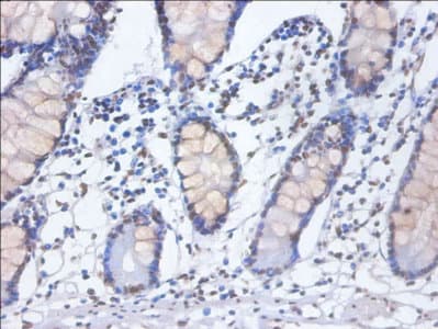 Polyclonal Rabbit anti-Human HNRNPD / AUF1 Antibody (IHC, WB)