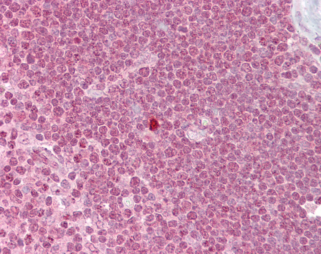 ZBTB7A / Pokemon Antibody (N-Terminus)