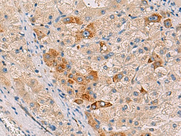 Polyclonal Rabbit anti-Human FAM82A1 Antibody (IHC, WB)