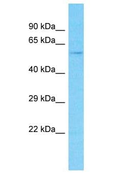 Polyclonal Rabbit anti-Human THUMPD3 Antibody (aa121-170, WB)