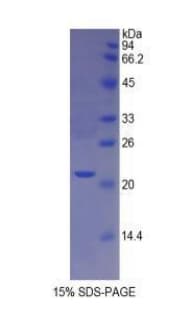 Mouse IVL / Involucrin Protein (Recombinant His)