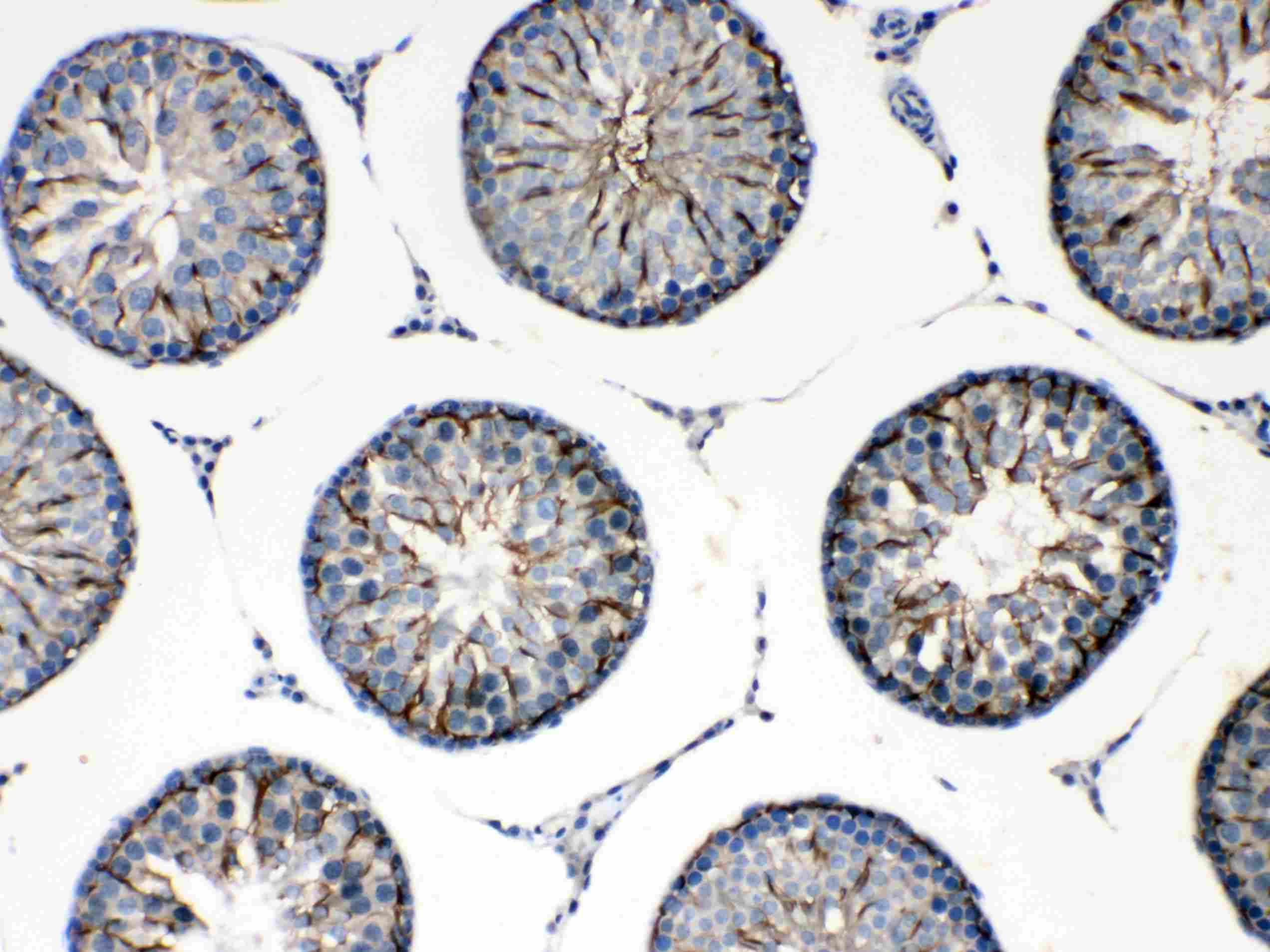 FMN1 Antibody