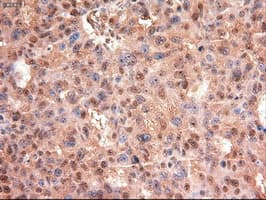MYC / c-Myc Antibody (clone OTI3F2)