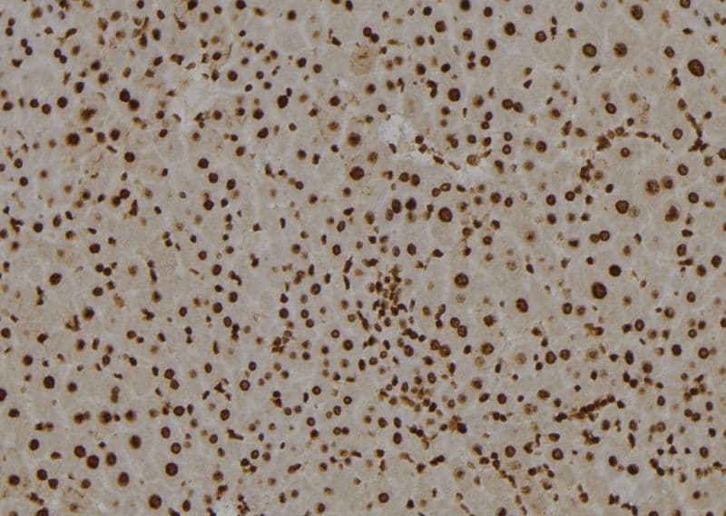 Polyclonal Rabbit anti-Human SMARCE1 / BAF57 Antibody (IHC, IF, WB)