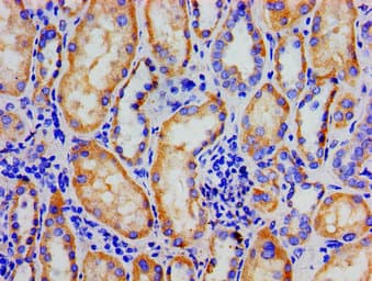 Polyclonal Rabbit anti-Human NR3C1/Glucocorticoid Receptor Antibody (IHC, IF, WB)
