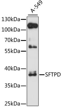 SFTPD / Surfactant Protein D Antibody