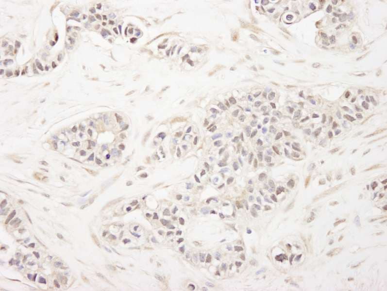 Polyclonal Rabbit anti-Human ZFPM1 / FOG1 Antibody (aa175-225, IHC)