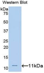 HNRNPA2B1 Antibody (aa21-103, PE)