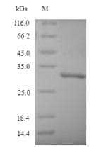 Mouse NQO1 Protein (Recombinant 6His, N-terminus)