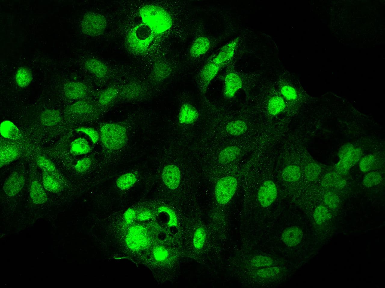 Polyclonal Rabbit anti-Human SLC15A1 / PEPT1 Antibody (IHC, IF)