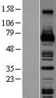 CSF1 / MCSF Protein (Over-Expression Lysate Myc-DDK (Flag))