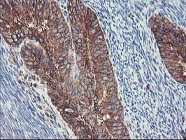 SH2D2A Antibody (clone OTI4F3)