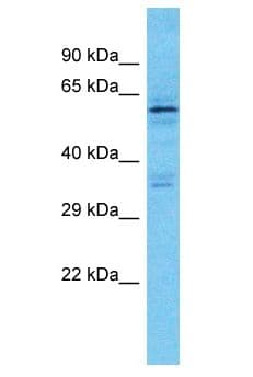 KRT76 / Keratin 76 Antibody (aa589-638)