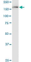 KDM6A / UTX Antibody (clone 4E7)