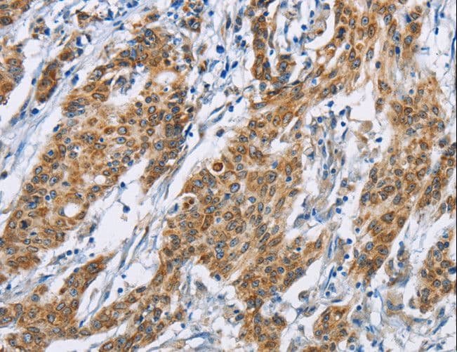 Polyclonal Rabbit anti-Human BTLA / CD272 Antibody (IHC)