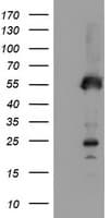 SCHIP1 Antibody (clone OTI2A11)