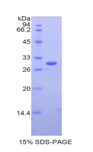 Mouse IL2RB / CD122 Protein (Recombinant His)