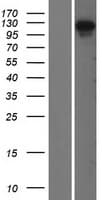 OFD1 Protein (Over-Expression Lysate Myc-DDK (Flag))