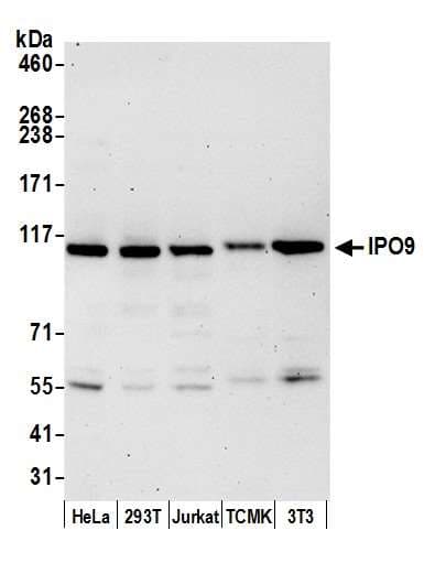 Polyclonal Rabbit anti-Human IPO9 / Importin 9 Antibody (aa925-975, WB)