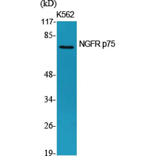 Polyclonal Rabbit anti-Human NGFR / CD271 / TNR16 Antibody (90-170 aa, Internal, IF, WB)