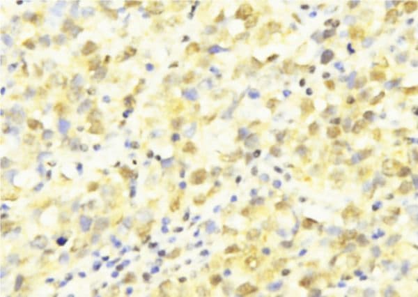Polyclonal Rabbit anti-Human HUS1 Antibody (IHC, WB)