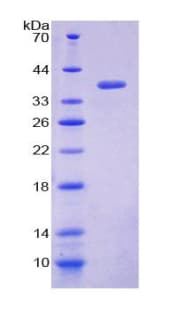 Human Loricrin Protein (Recombinant His-GST)