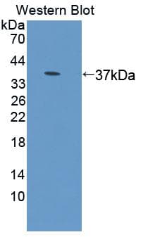 CBR / CBR1 Antibody (aa2-271)