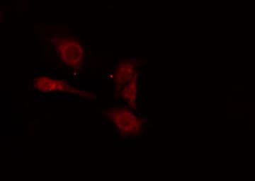 Polyclonal Rabbit anti-Human RRM2B / P53R2 Antibody (IF, WB)