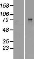 Human CARS1 / CARS Protein (Over-Expression Lysate Myc-DDK (Flag))