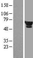 FTCD / 58K Golgi Protein (Over-Expression Lysate Myc-DDK (Flag))