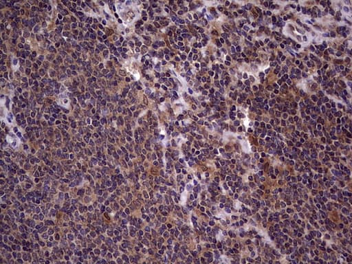 Monoclonal Mouse anti-Human BFSP2 Antibody (clone OTI4E7, aa184-415, IHC, WB)