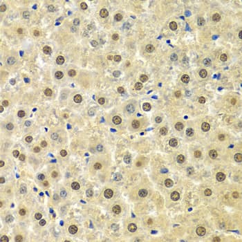 SPHK / SPHK1 Antibody