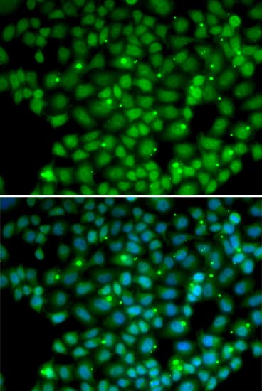 Polyclonal Rabbit anti-Human MUTYH / MYH Antibody (IHC, IF, WB)