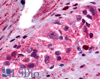 IHC-plus™ Polyclonal Rabbit anti-Human PTGER4 / EP4 Antibody (N-Terminus, IHC)