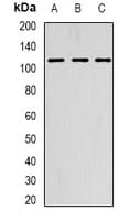 AARS2 Antibody