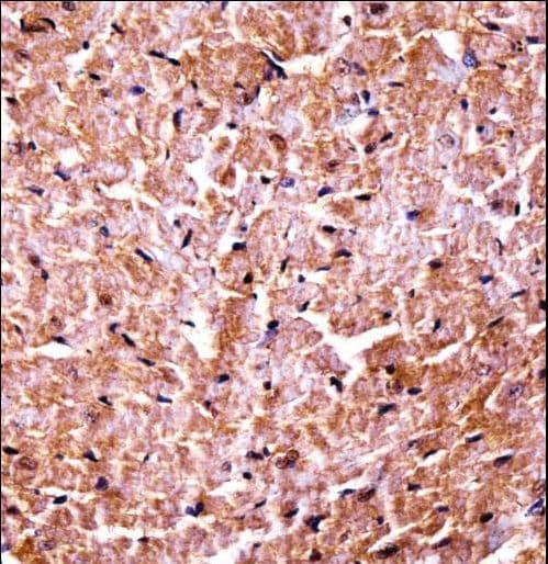 CAMK2D / CaMKII Delta Antibody (aa221-250)