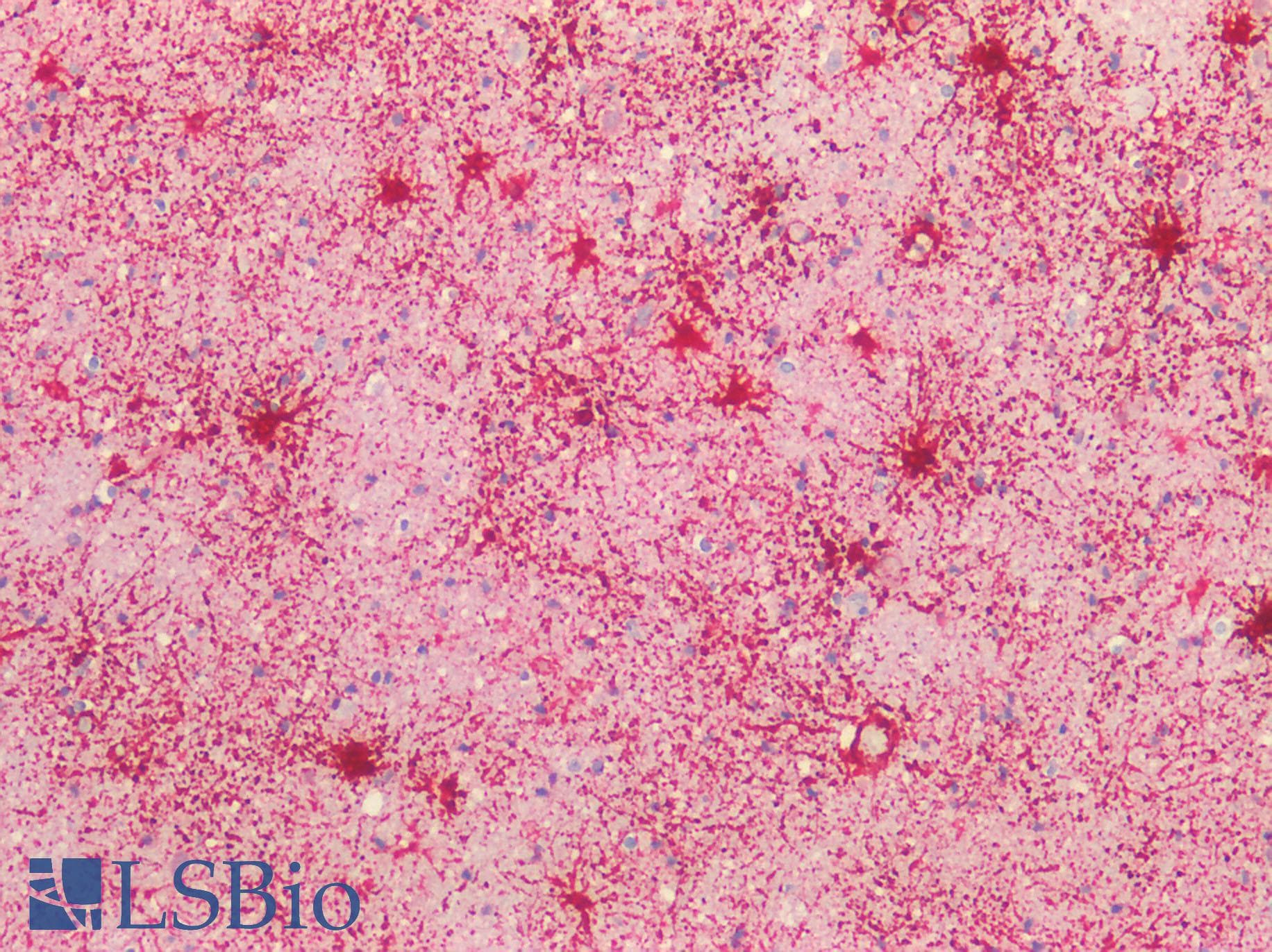 IHC-plus™ GFAP Antibody (C-terminal domain of human)