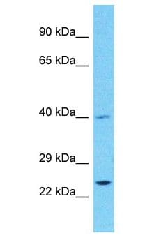 Polyclonal Rabbit anti-Human PRSS55 Antibody (aa271-320, WB)