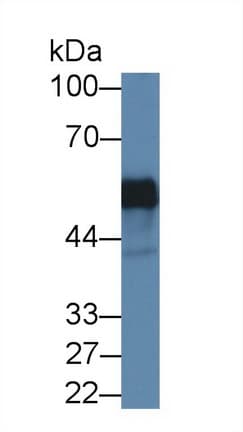 JMJD6 / PSR Antibody (aa1-334)