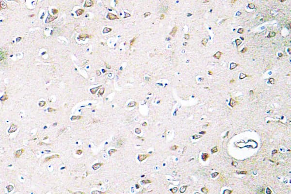 Polyclonal Rabbit anti-Human PIK3R2 / p85 Beta Antibody (Gln496, IHC)