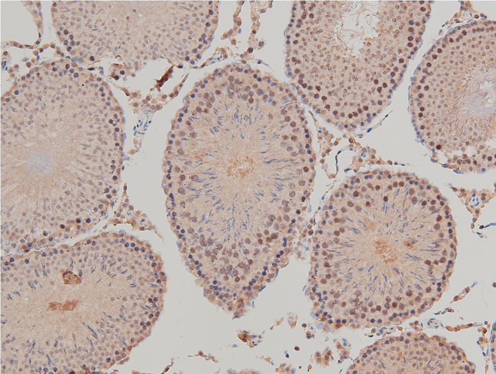 LIMK1 / LIMK Antibody (phospho-Thr508)