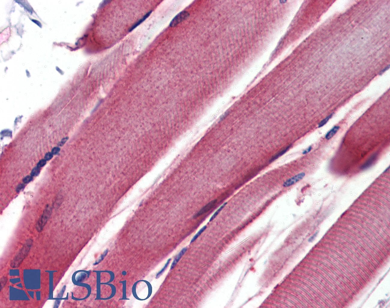 Polyclonal Rabbit anti-Human GSTM2 Antibody (aa71-120, IHC, WB)