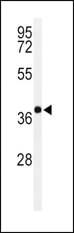 Polyclonal Rabbit anti-Human PAX6 Antibody (aa352-380, IHC, IF, WB)
